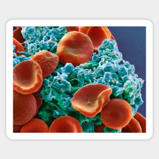 Red blood cells and platelets, SEM (C029/3211) Sticker